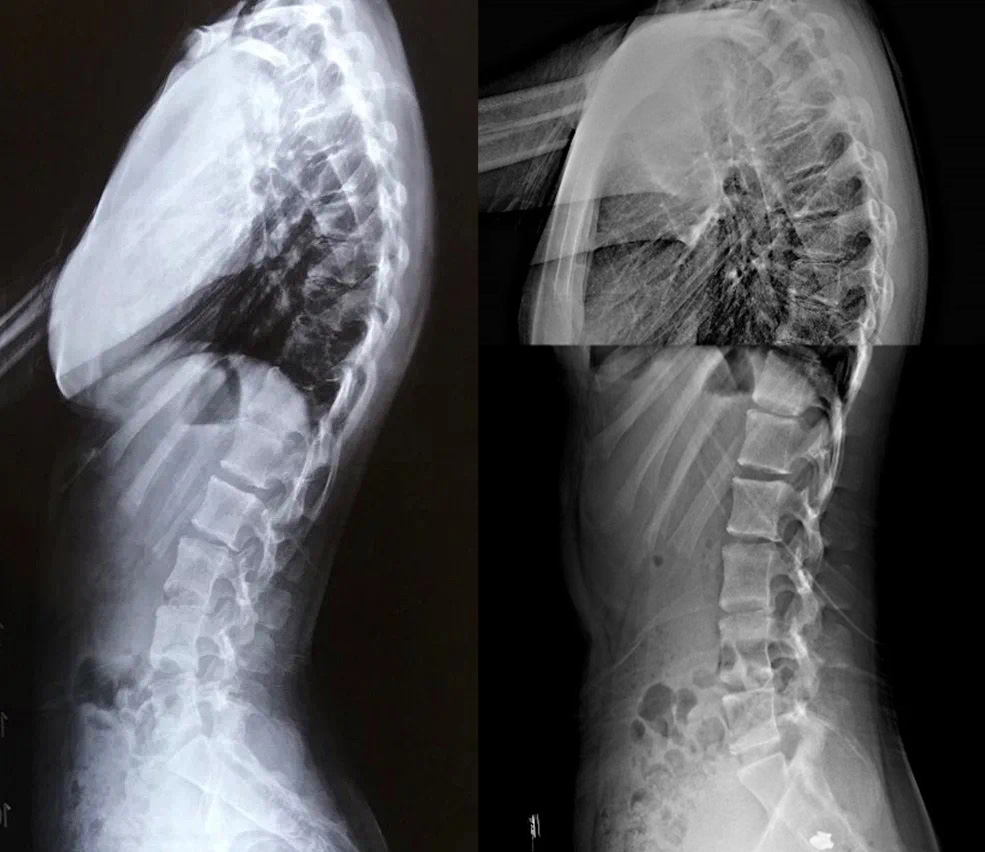 Xray Before and After UP Clinic Shanghai China